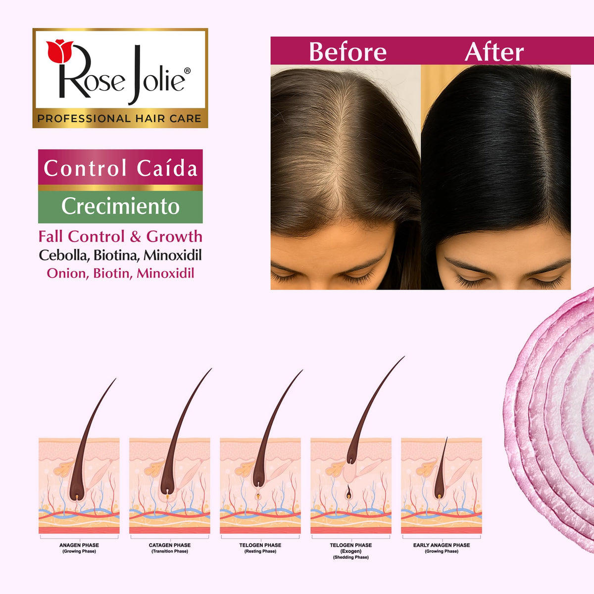 Leave-In Conditioner with Onion Extract & Biotin 10 oz K57192